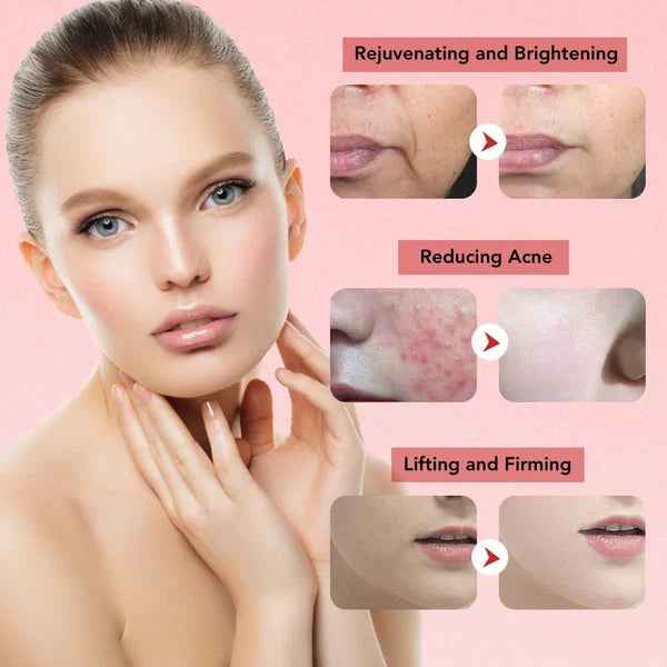 Face Lift Device Facial Massager